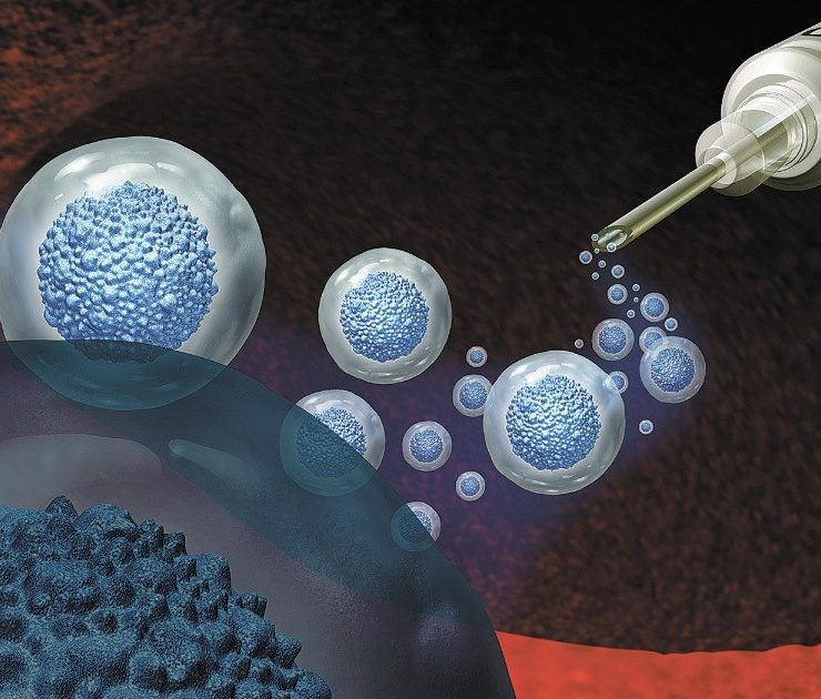 La falta de preparación para las pandemias