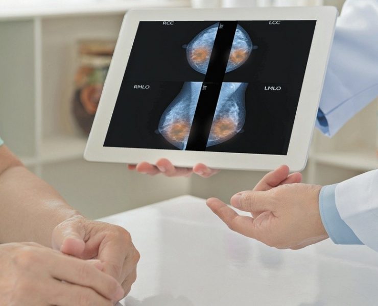 Un apretón del seno puede ser un regalo de vida; hazte la mastografía