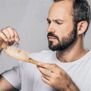 Alopecia androgénica afecta la autoestima y la seguridad personal