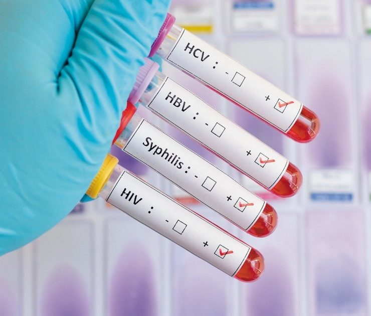 Diagnóstico, cuidado, prevención, claves para frenar una infección