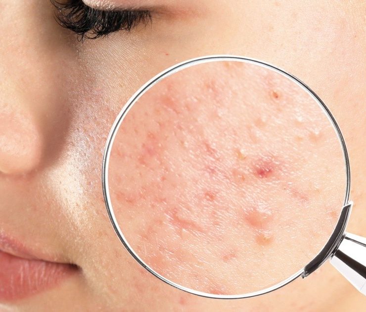 Enfermedades dermatológicas afectan al 80% de la población