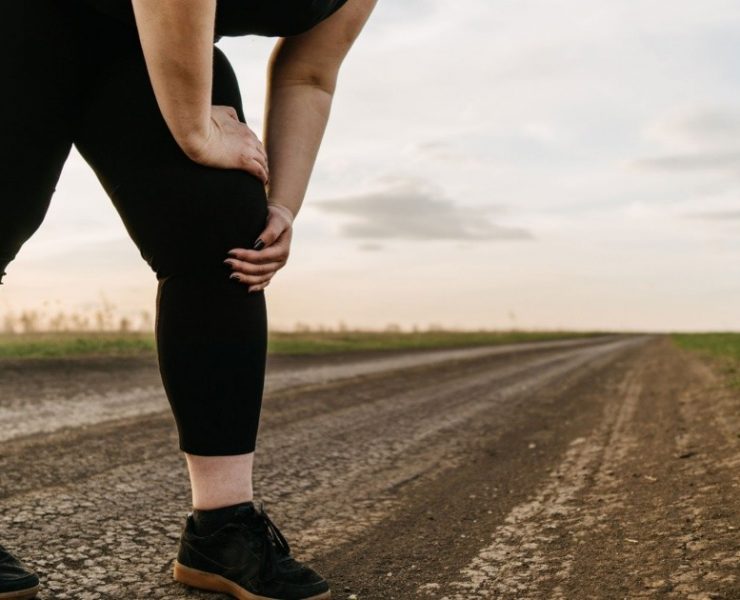 Lipedema, un mal infradiagnosticado