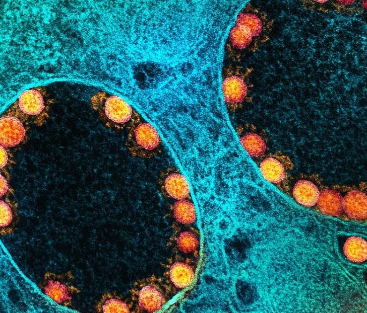 ¿Es el coronavirus un ser vivo?